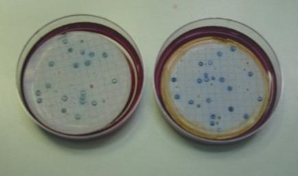 Bacteria on gel plates Bacteria on gel plates